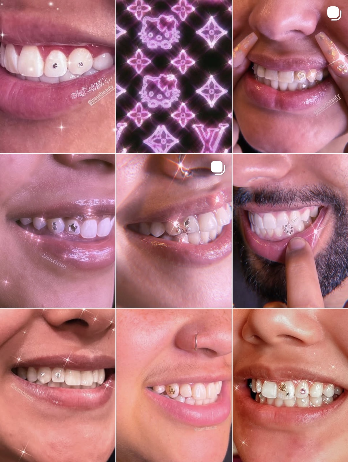 Tooth gems